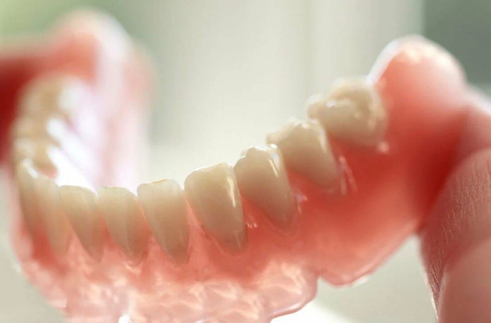 Prótese dentária removível